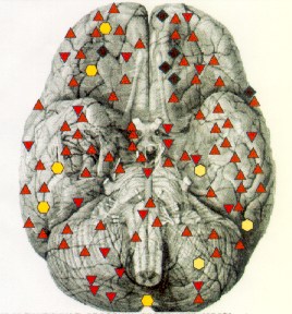 Паутинная 


оболочка головного мозга